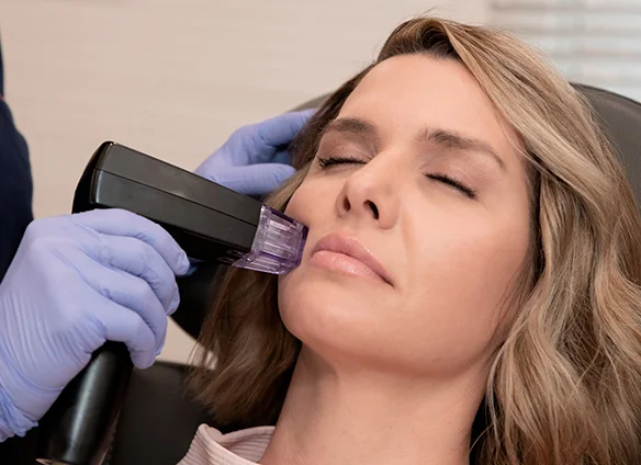 Is Morpheus8 Safe for All Skin Types?